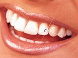 Новости Днепра про Высококачественная стоматологическая помощь только в стоматологической клинике «Angeldent»!