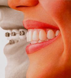 Новости Днепра про Высококачественная стоматологическая помощь только в стоматологической клинике «Angeldent»!