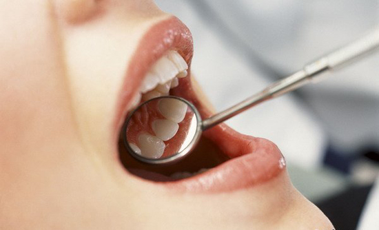 Новости Днепра про АКЦИЯ на профессиональную чистку зубов в клинике «Дентал Вайт»!