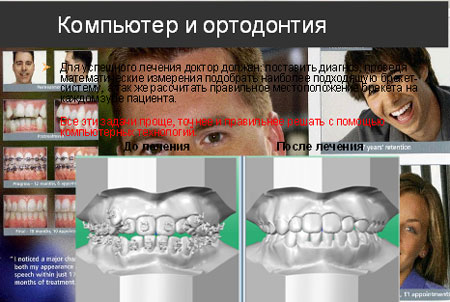 Новости Днепра про Кабинет ортодонтии «Ортодонт» является официальным диллером российской компании «Рудент» в Украине!