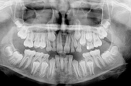 Новости Днепра про С чего начинать лечение у врача-стоматолога?