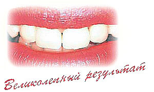 Новости Днепра про Ортопедическое лечение в стоматологии «Дентим-А»!
