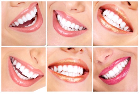 Новости Днепра про Отбеливание зубов в  стоматологии «San Marco»