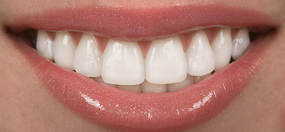Новости Днепра про Быстрое и безопасное отбеливание зубов