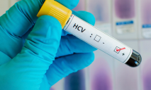 В Украине более миллиона человек инфицированы гепатитом С