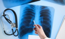 Больные туберкулезом среди нас: шокирующие подробности лечения от МОЗ