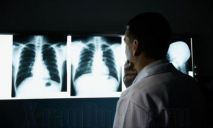 Супрун: анкеты лучше флюорографии выявят туберкулез