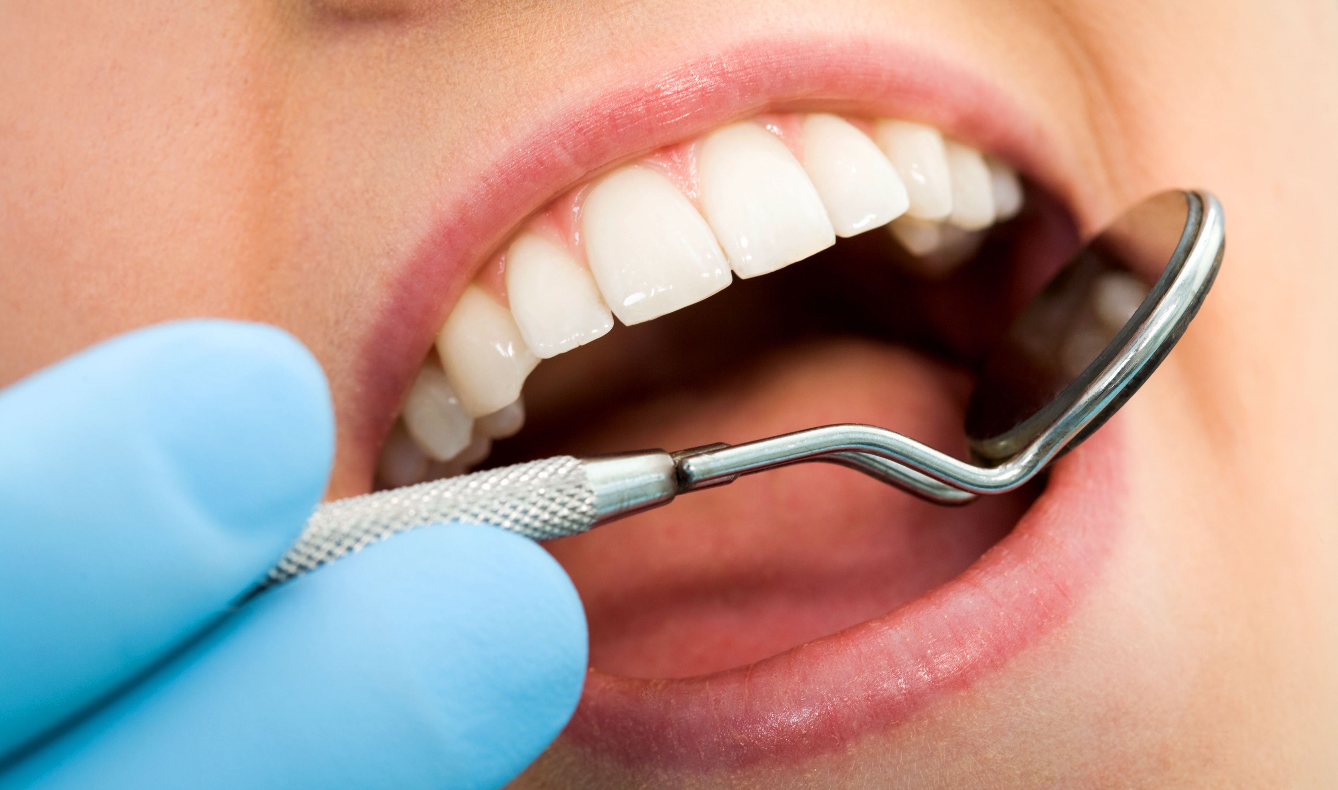 Новости Днепра про Косметическая реставрация зубов в стоматологии «Дентим-А»