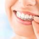 Клиника «Сан Марко» – выравнивание зубов по передовым технологиям