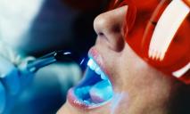 Клиника «Сан Марко» предлагает эффективное отбеливание зубов по инновационной методике