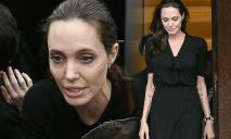 Жизнь в опасности: Анджелина Джоли попала в больницу
