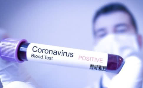 Развенчиваем мифы про коронавирус: заявления врачей. Новости Днепра