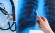 На Днепропетровщине туберкулез будут лечить всего в двух городах