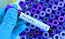 Третья смерть: в Украине возросло количество жертв коронавируса