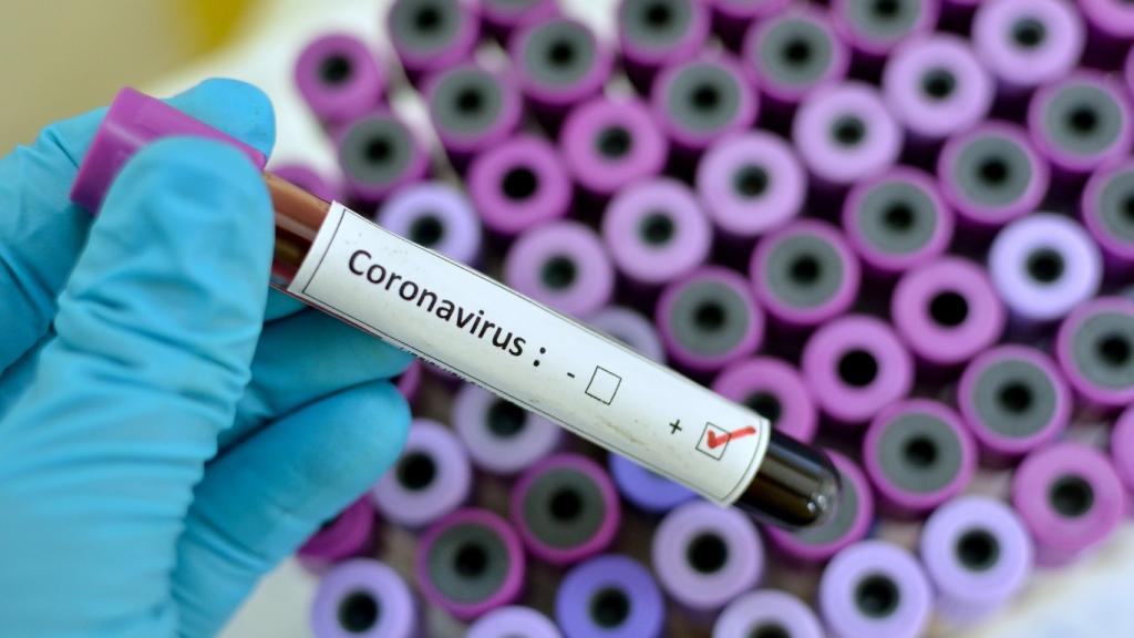 У 9 человек в Украине заподозрили коронавирус: как защитить себя. Новости Украины