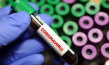 За сутки в Украине зафиксировано 478 новых случаев коронавируса