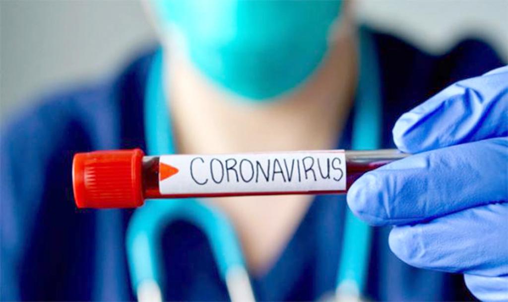 143 новых случая за сутки: ситуация с коронавирусом в Украине. Новости Украины