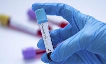 Тесты на коронавирус в Днепре: кого будут проверять
