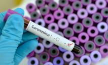 Днепропетровщина отказывается от экспресс-тестов на коронавирус