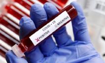 Коронавирус в Днепре: новые случаи заболевания