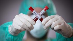 За прошедшие сутки в Украине было подтверждено более 700 новых случаев заражения коронавирусом. Новости Украины