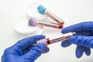 В Украине растет заболеваемость коронавирусом. Новости Украины