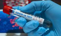 В Днепре за сутки коронавирусом заразились 129 людей