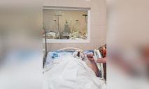 Страшные ожоги: в Днепре в больнице Мечникова спасают мужчину