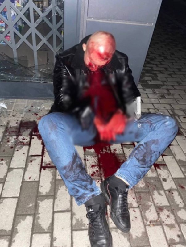 Новости Днепра про В Днепре пьяный мужчина разбил головой витрину магазина: он в больнице