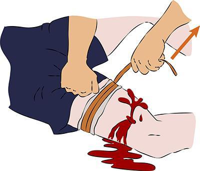 Новости Днепра про Медицинская помощь при ДТП и ракетных обстрелах: как остановить кровотечение