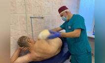 Осколок відрізав руку та покалічив ногу: у лікарні Дніпровській Мечникова рятують чоловіка