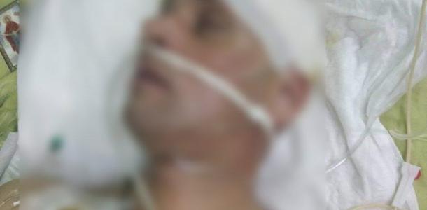 Без сознания провел месяц в реанимации: в Днепре спасали военного с тяжелым ранением