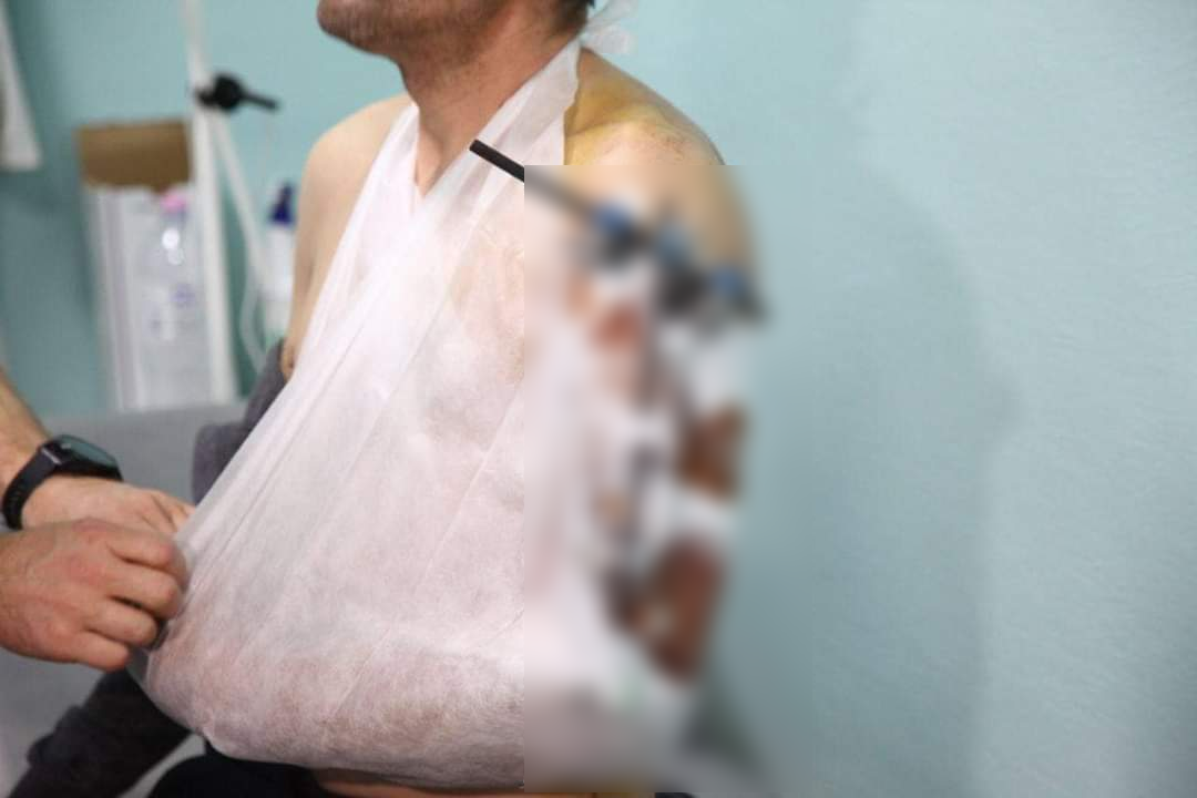 Новости Днепра про Пекучий біль знищував зсередини: у лікарні Дніпра врятували 34-річного військового