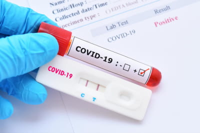 Новости Днепра про Берегите себя: какова ситуация с коронавирусом в Днепре на вечер 10 января