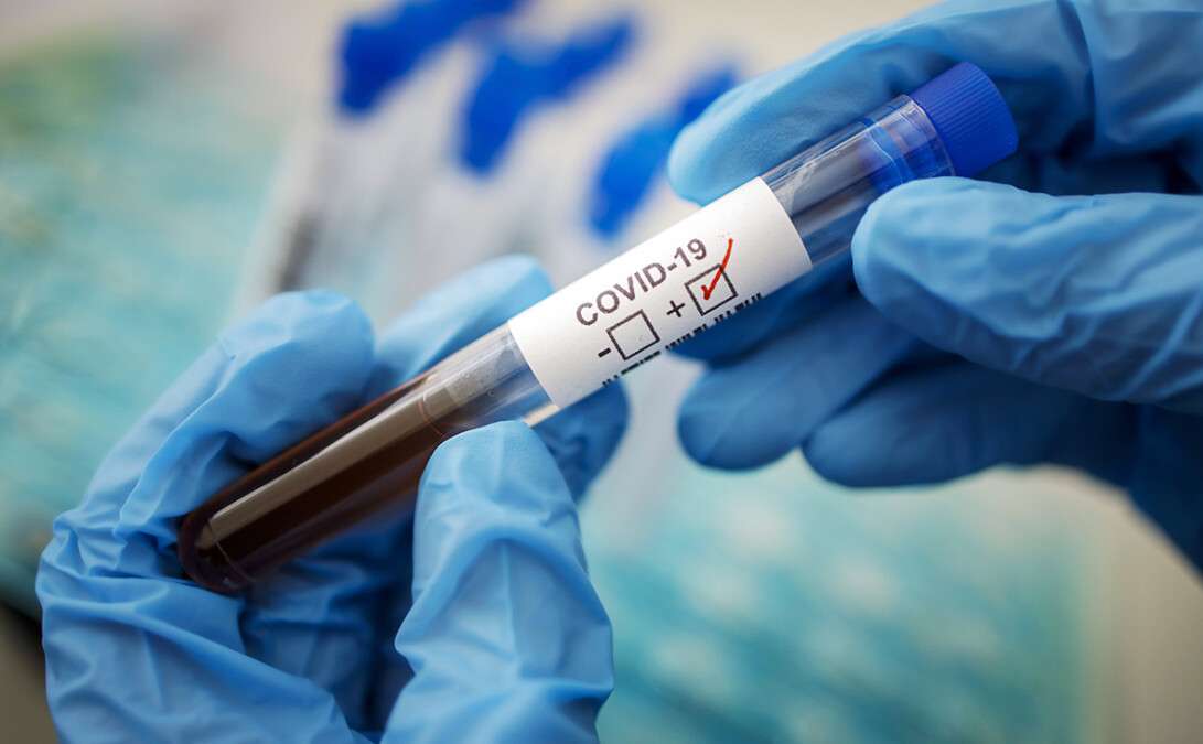 Новости Днепра про 35 людей у Дніпрі заразилися коронавірусом за добу