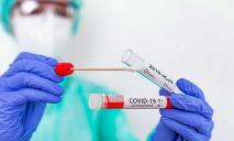 43 человека в больнице: в Днепре фиксируют новые случаи коронавируса