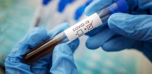 COVID-19 не отспупает: в Днепре зафиксировали 21 случай заболевания