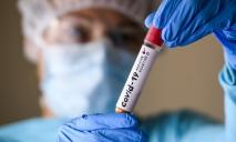 В Днепре зафиксировали 64 новых случаев коронавируса