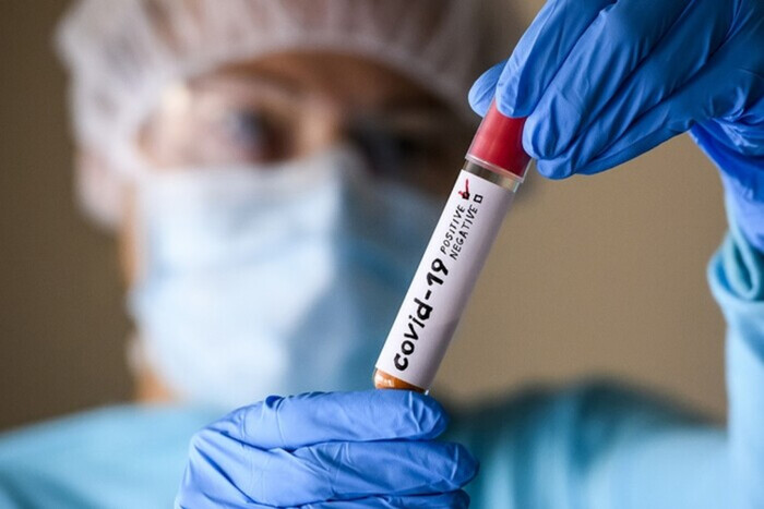 Новости Днепра про У Дніпрі зафіксували 64 нових випадків коронавірусу