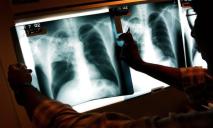 Днепропетровщина лидер по количеству больных туберкулезом