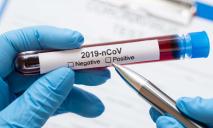 Хвороба атакує: у Дніпрі за добу виявили 73 випадки COVID-19