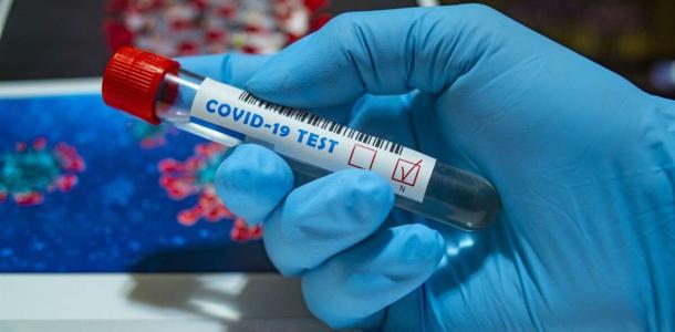 В Днепре за сутки почти сотня людей заболели коронавирусом