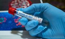 Болезнь не пропадает: более сотни новых случаев коронавируса обнаружили в Днепре
