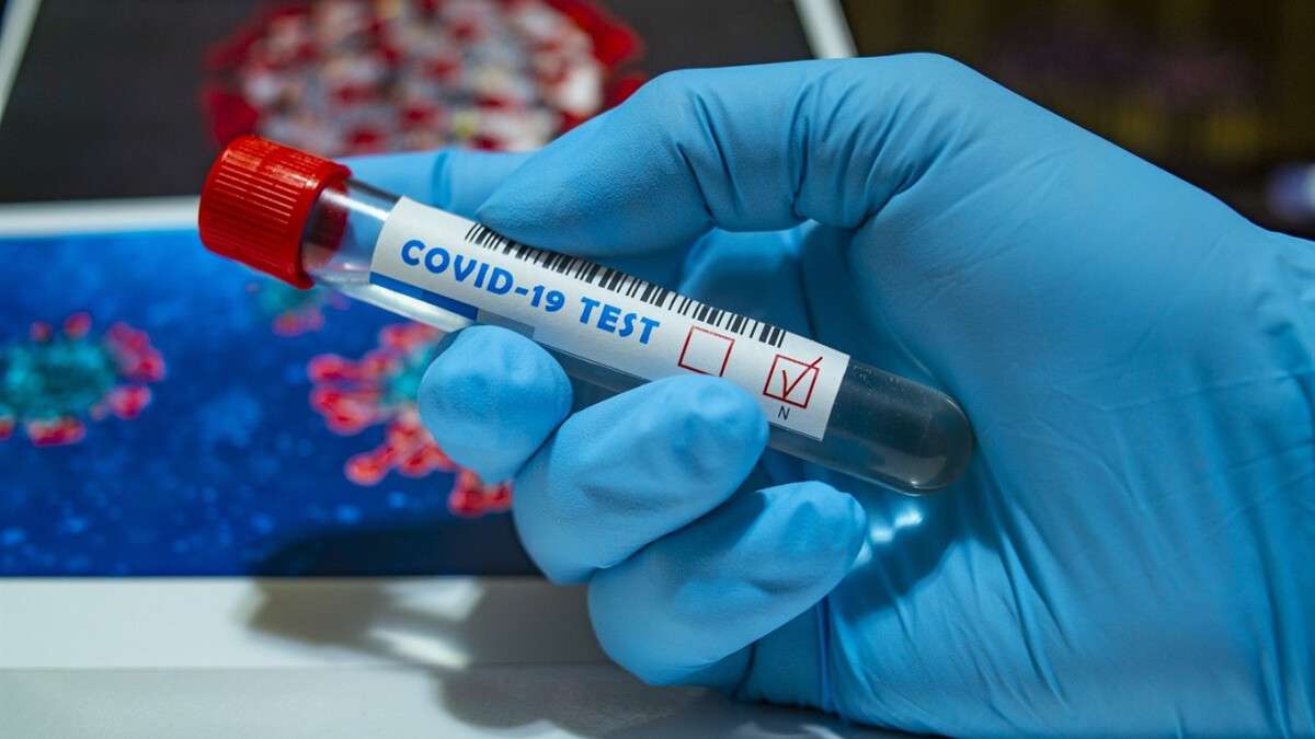 Новости Днепра про У Дніпрі за добу майже сотня людей захворіли на коронавірус