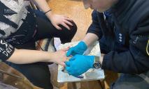 Палец опух: в Днепре спасатели помогли женщине снять обручальное кольцо