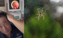 В Китае паук залез в ухо мужчины и свил там паутину: шокирующее видео