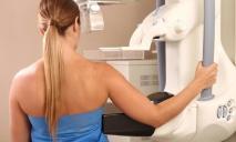 Як у Дніпрі безкоштовно пройти мамографію у 2023 році і що для цього потрібно