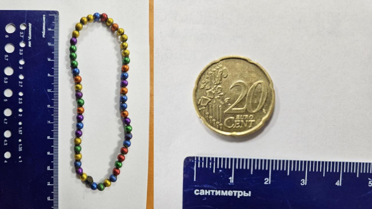 Новости Днепра про Проковтнули 20-центову монету та 50 магнітних кульок: у Дніпрі рятували дітей