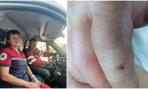 Гризнула за палец: на Днепропетровщине мужчина загремел в больницу после укуса гадюки