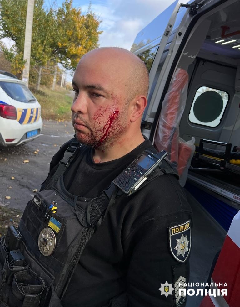 Новости Днепра про На Дніпропетровщині зловмисник поранив поліцейського ножем в обличчя